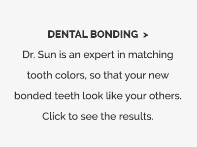 Dental Bonding